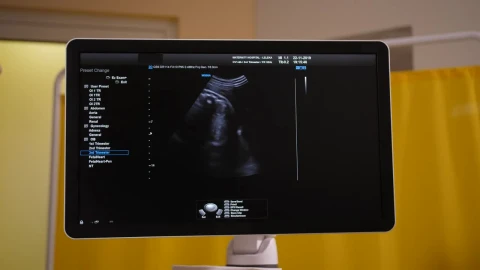 Stock Footage Ultrasound Scan On A Monitor Live Wallpaper animated wallpaper preview