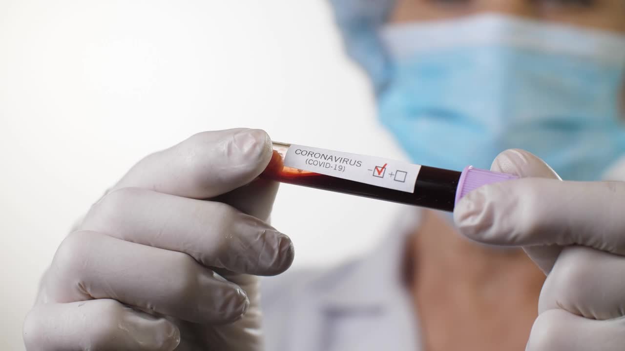 Download Stock Video Coronavirus Test In The Hands Of A Doctor Live Wallpaper For PC