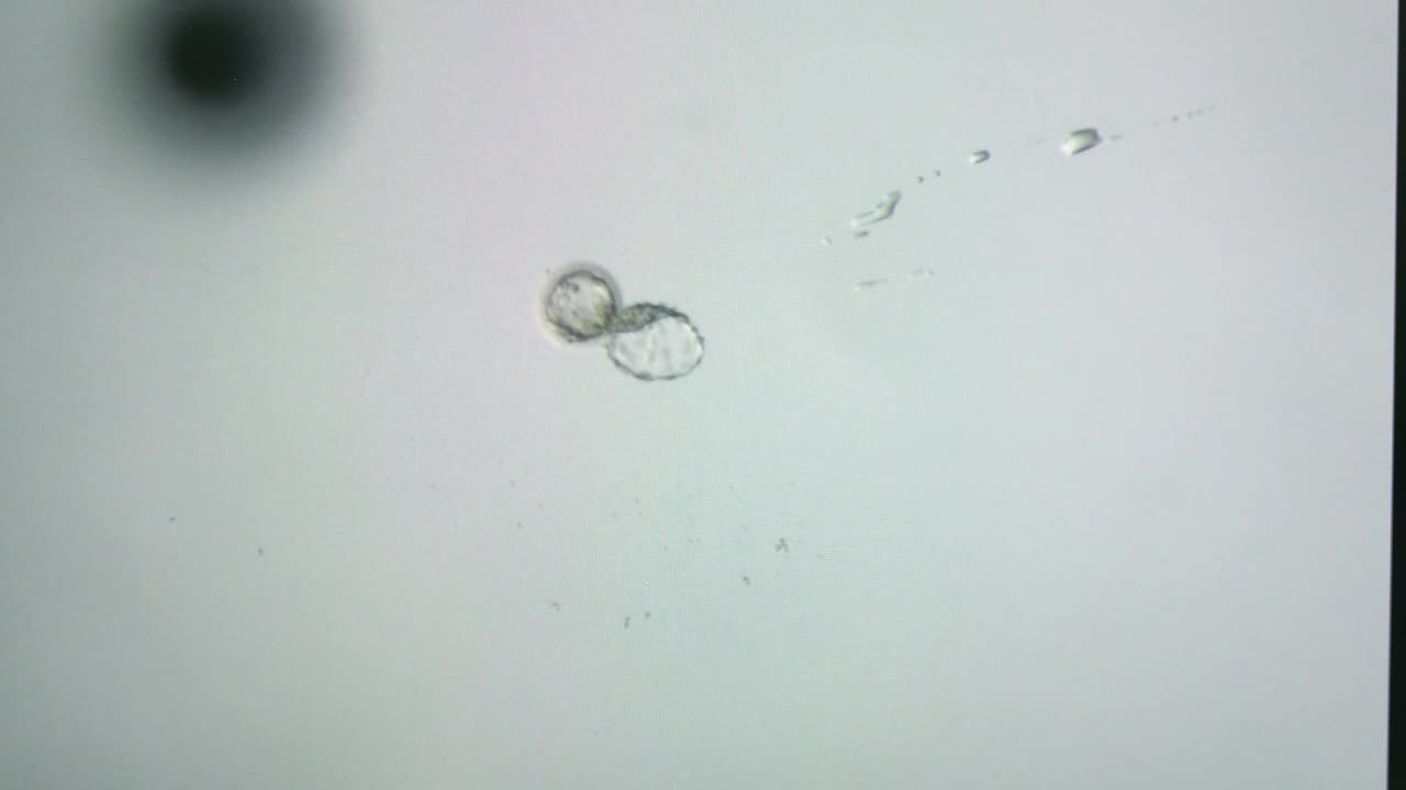 Download Stock Video Embryo Under A Microscope View Live Wallpaper For PC