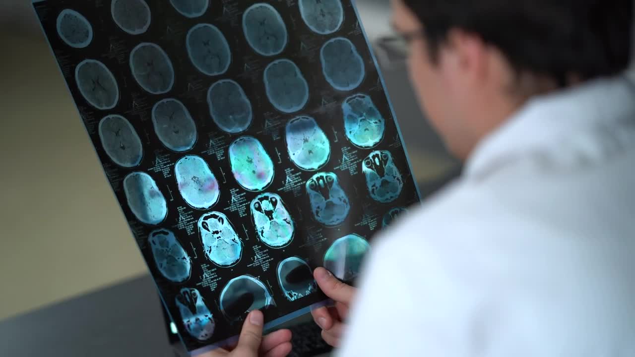 Download Stock Video Doctor Looking At An X Ray Of The Skull Live Wallpaper For PC