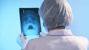 Stock Video Female Doctor Looking At The X Ray Of A Skull Live Wallpaper For PC
