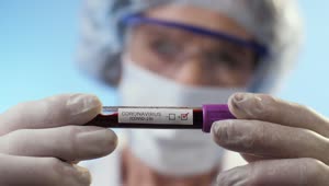 Video Stock Positive Blood Test For Coronavirus Shallow Focus Live Wallpaper Free