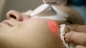 Stock Footage Woman Having Skin Laser Treatment Live Wallpaper Free