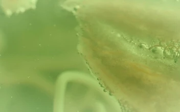 Stock Video Bacteria In Detail For PC