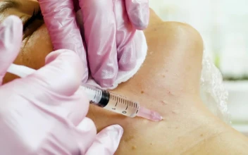 Stock Video Cosmetologist Making Face Lifting Injections For PC