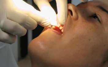 Stock Video Girl In A Procedure At The Dentist For PC