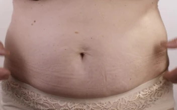Stock Video Obese Woman Touching Her Stomach