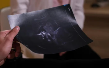 Stock Video Parents Holding An Ultrasound Photo
