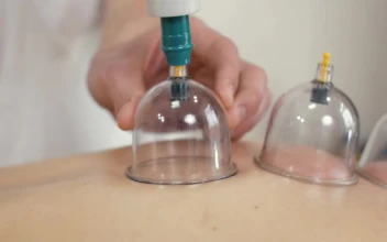Video Stock Person Taking Vacuum Massage Therapy Free
