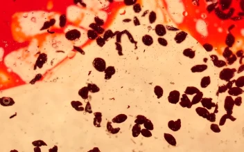 Video Stock Petri Blood Cells Free