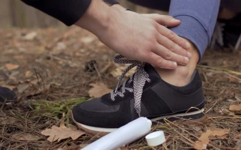 Free Video Stock Smearing Ointment On A Persons Ankle