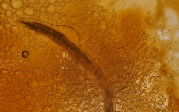 Free Video Stock thick bacterial yellow liquid