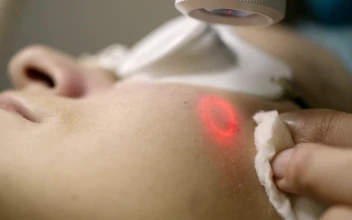 Stock Footage Woman Having Skin Laser Treatment Free