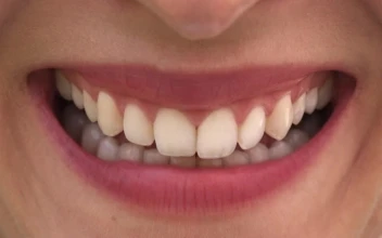 Stock Footage Woman Smiling With White Teeth Free
