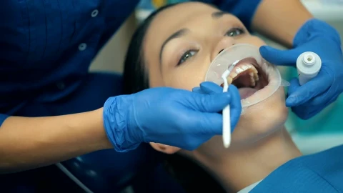 Stock Video Dentist Hands Cleaning Teeth To A Patient Live Wallpaper For PC - Free Live Wallpaper