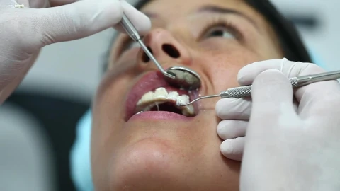 Stock Video Dentist Hands Cleaning Teeth Before Surgery Live Wallpaper For PC - Free Live Wallpaper