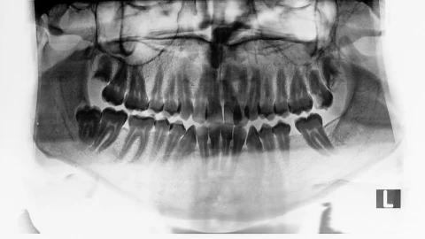 Stock Video Dental X Ray Live Wallpaper For PC - Free Live Wallpaper