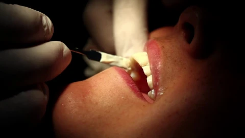 Stock Video Dental Surgery Close Up Live Wallpaper For PC - Free Live Wallpaper