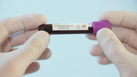 Stock Video Covid  Test In A Lab Tube Live Wallpaper For PC - Free Live Wallpaper