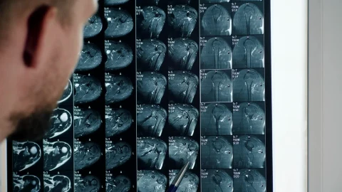Stock Video Doctor Looking At X Rays Live Wallpaper For PC - Free Live Wallpaper