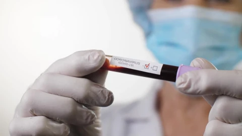 Stock Video Doctor Holding A Covid  Blood Test Live Wallpaper For PC - Free Live Wallpaper