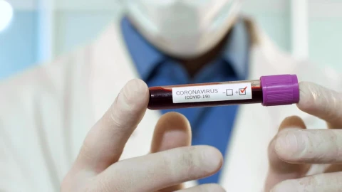 Stock Video Doctor Holding A Blood Sample With Coronavirus Live Wallpaper For PC - Free Live Wallpaper
