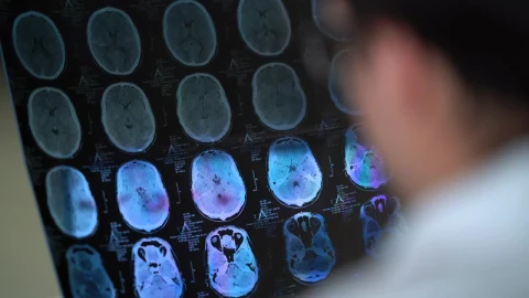 Stock Video Doctor Analyzing A Skull Tomography Live Wallpaper For PC - Free Live Wallpaper