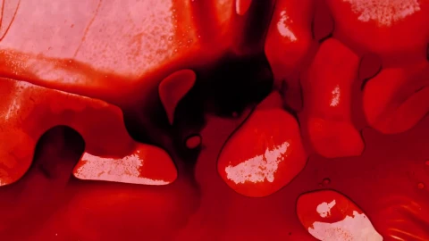 Stock Video Infected Blood Under A Microscope Animated Wallpaper - Free Live Wallpaper