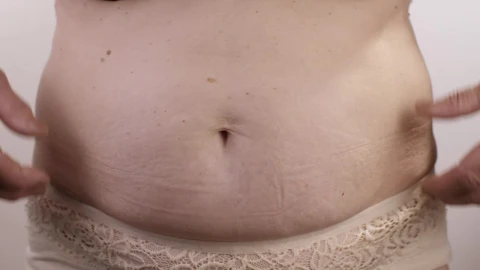 Stock Video Obese Person Touching His Stomach Live Wallpaper - Free Live Wallpaper