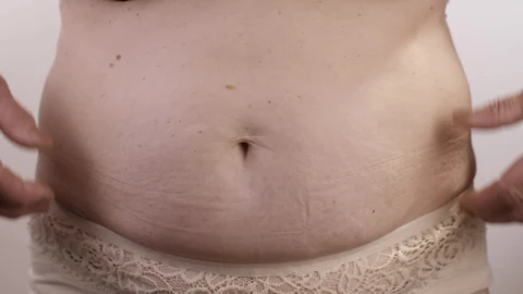 Stock Video Obese Woman Touching Her Stomach Live Wallpaper - Free Live Wallpaper