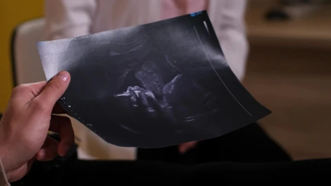Stock Video Parents Holding An Ultrasound Photo Live Wallpaper - Free Live Wallpaper