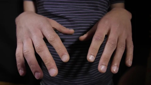 Stock Video Parkinsons Sick Person Live Wallpaper - Free Live Wallpaper