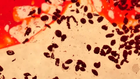Video Stock Petri Blood Cells Live Wallpaper Free - Free Live Wallpaper