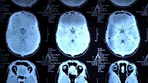 Free Video Stock Skull X Rays View Live Wallpaper - Free Live Wallpaper