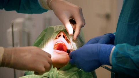 Free Video Stock surgeons working on a patients mouth Live Wallpaper - Free Live Wallpaper