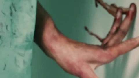 Free Stock Video Wandering Walking Of A Zombie Male Nurse Live Wallpaper - Free Live Wallpaper