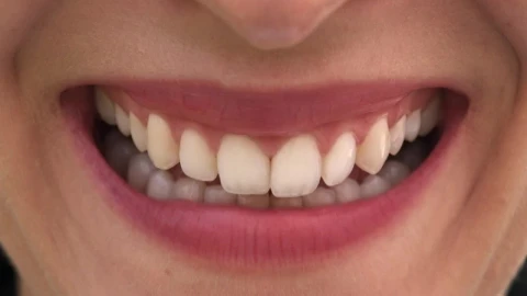 Stock Footage Woman Smiling With White Teeth Live Wallpaper Free - Free Live Wallpaper